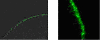 Figure 1: Fluorescent micrographs of cryostat sections from Xenopus laevis oocytes injected with MRP1-EGFP (left panel) and MRP2-EGFP (right panel) fusion cRNA. Note the strong expression of either fusion protein in the plasma membrane